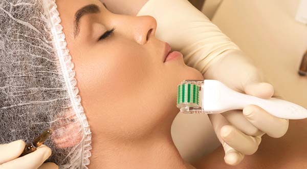 woman receiving micro needling treatment around her chin