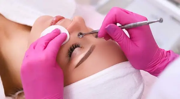 acne and pimples being removed during a facial for acne removal